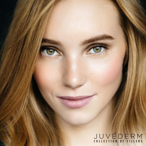 JUVÉDERM® Ultra Plus XC 1ml
